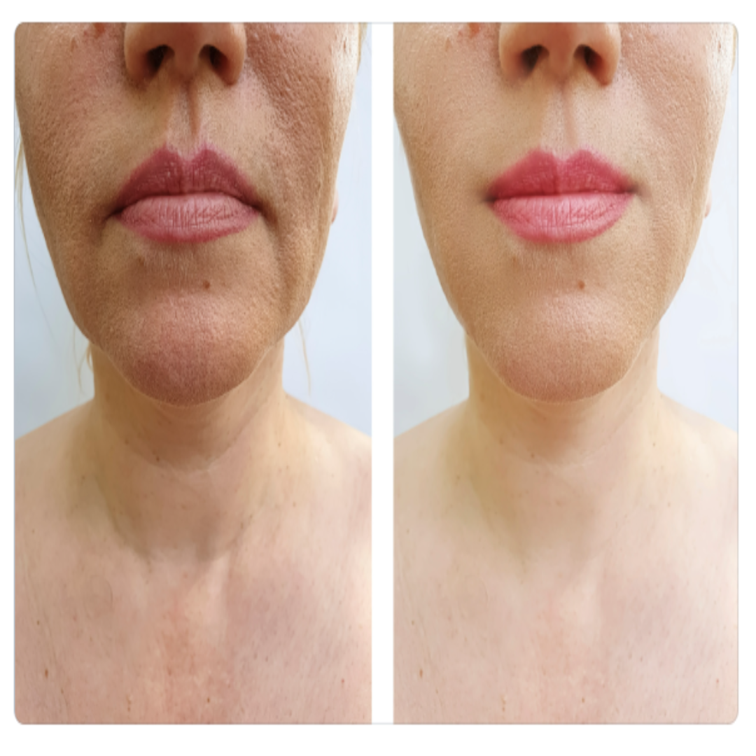 Onyx Neck Renewal Cream for Women