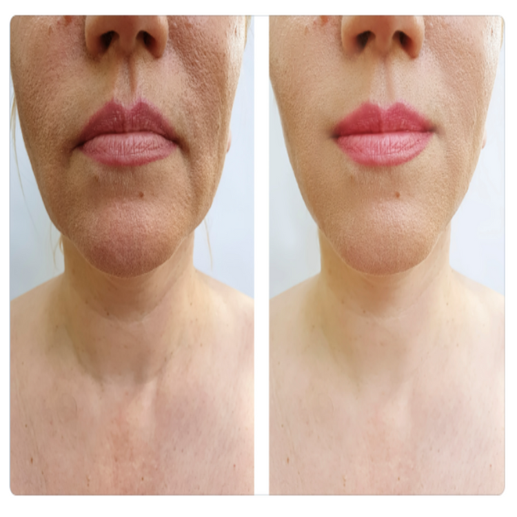 Onyx Neck Renewal Cream for Women
